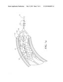 IMPEDANCE DEVICES FOR OBTAINING CONDUCTANCE MEASUREMENTS WITHIN LUMINAL     ORGANS diagram and image