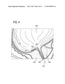 HIGH INTENSITY FOCUSED ULTRASOUND WITH CAPACITIVE MICROMACHINED     TRANSDUCERS diagram and image