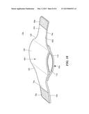 INFLATABLE COMPRESSION WRAP FOR DIRECT SUPPORT OF THE SPINOUS PROCESS IN     THE LUMBAR SPECIFIC SPINE REGION diagram and image