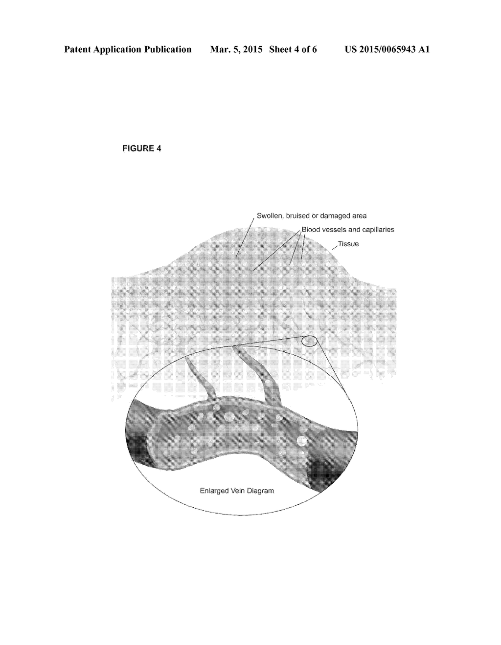 Method to Accelerate Healing - diagram, schematic, and image 05