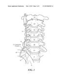 SPINAL NEUROMODULATION AND ASSOCIATED SYSTEMS AND METHODS diagram and image