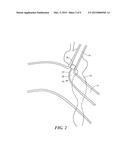 SPINAL NEUROMODULATION AND ASSOCIATED SYSTEMS AND METHODS diagram and image