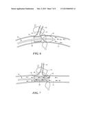 SPINAL NEUROMODULATION AND ASSOCIATED SYSTEMS AND METHODS diagram and image