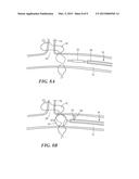 SPINAL NEUROMODULATION AND ASSOCIATED SYSTEMS AND METHODS diagram and image