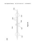 PLEURAL DRAINAGE SYSTEM AND METHOD OF USE diagram and image