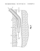 EXPANDABLE VASCULAR CLOSURE PLUG diagram and image