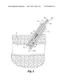 EXPANDABLE VASCULAR CLOSURE PLUG diagram and image