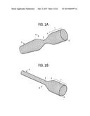 Methods, Apparatuses and Systems for Caval Stenting for Venous Drainage diagram and image