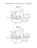 Methods, Apparatuses and Systems for Caval Stenting for Venous Drainage diagram and image