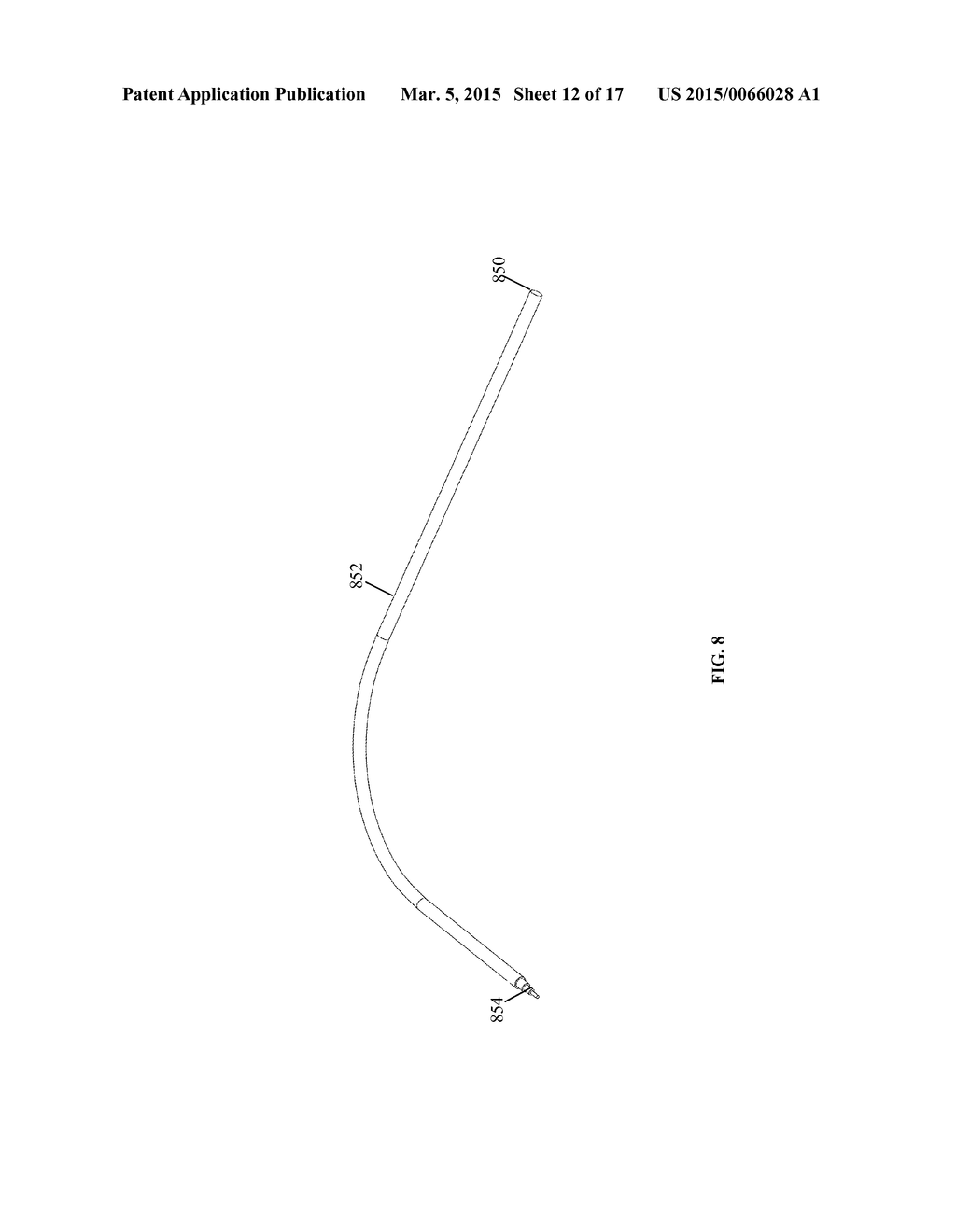 Systems and Methods for Internal Bone Fixation - diagram, schematic, and image 13