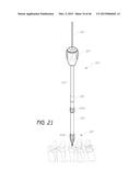 MINIMALLY INVASIVE DEVICES AND METHODS FOR DELIVERING FIXATION DEVICES AND     IMPLANTS INTO A SPINE diagram and image