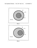 CATHETER LUMEN PARTITIONER diagram and image