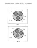 CATHETER LUMEN PARTITIONER diagram and image