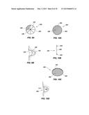 MEDICAL DEVICE FOR MODIFICATION OF LEFT ATRIAL APPENDAGE AND RELATED     SYSTEMS AND METHODS diagram and image