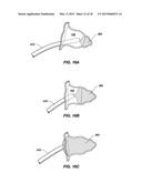 MEDICAL DEVICE FOR MODIFICATION OF LEFT ATRIAL APPENDAGE AND RELATED     SYSTEMS AND METHODS diagram and image