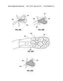 MEDICAL DEVICE FOR MODIFICATION OF LEFT ATRIAL APPENDAGE AND RELATED     SYSTEMS AND METHODS diagram and image