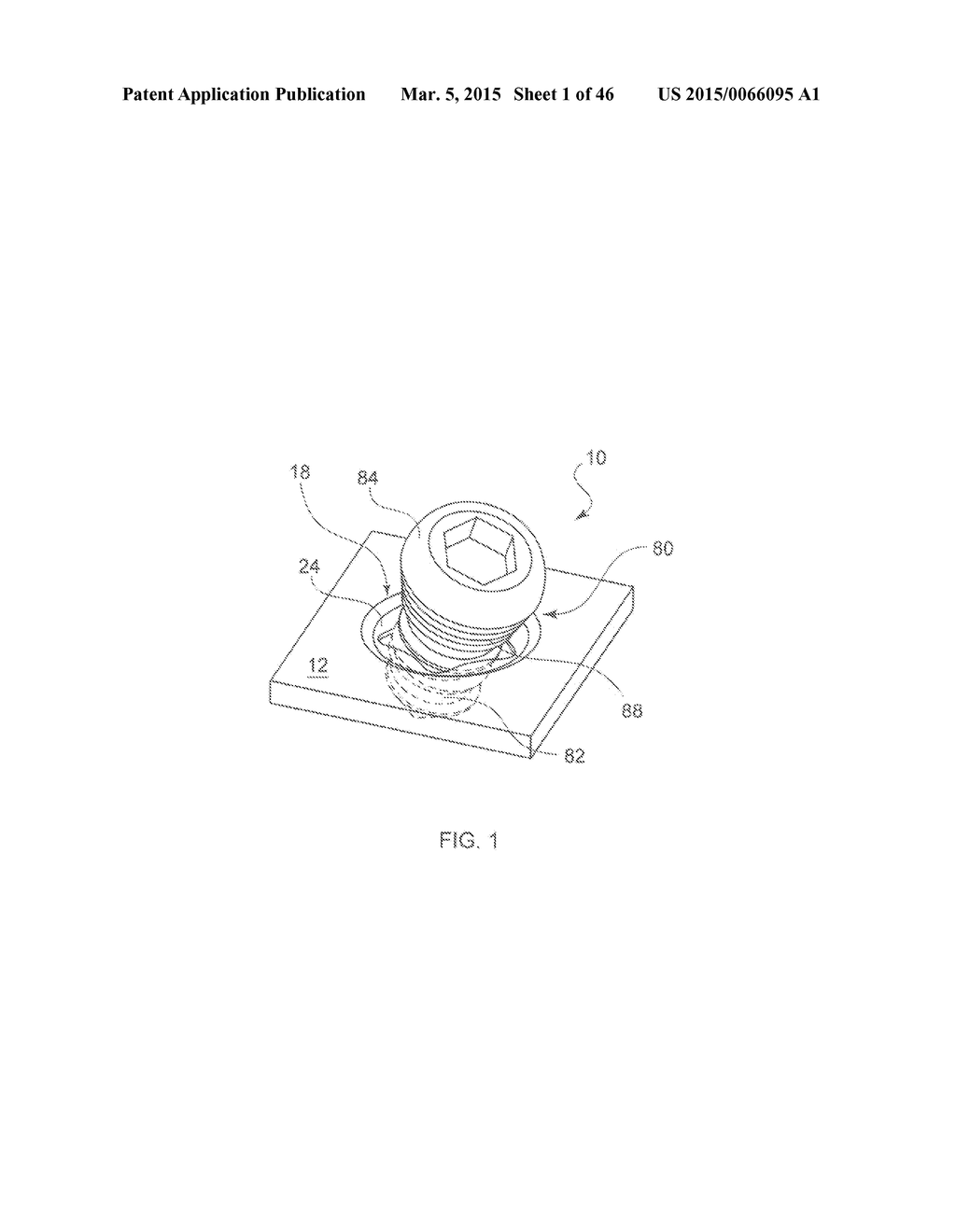 SYSTEMS AND METHODS FOR USING POLYAXIAL PLATES - diagram, schematic, and image 02