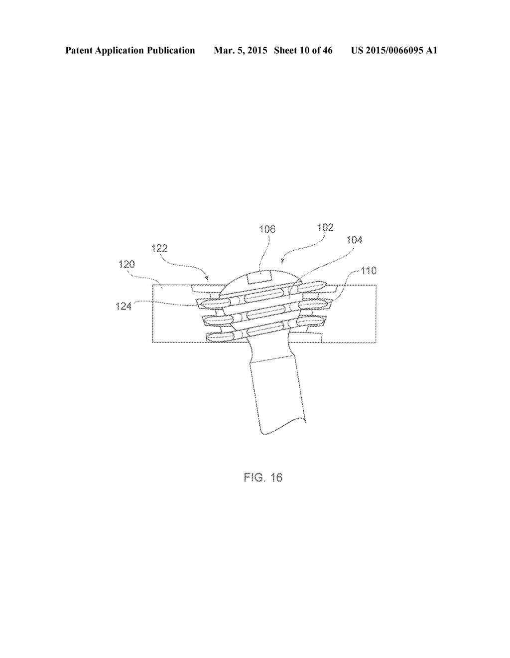 SYSTEMS AND METHODS FOR USING POLYAXIAL PLATES - diagram, schematic, and image 11