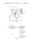 METHODS, SYSTEMS, AND DEVICES FOR PAIRING VAGUS NERVE STIMULATION WITH     MOTOR THERAPY IN STROKE PATIENTS diagram and image