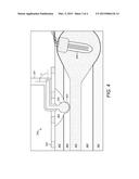 Fenestration Electrode to Treat Patients with Meniere s Disease diagram and image