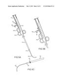 HEART ANCHOR POSITIONING DEVICES, METHODS, AND SYSTEMS FOR TREATMENT OF     CONGESTIVE HEART FAILURE AND OTHER CONDITIONS diagram and image