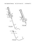 HEART ANCHOR POSITIONING DEVICES, METHODS, AND SYSTEMS FOR TREATMENT OF     CONGESTIVE HEART FAILURE AND OTHER CONDITIONS diagram and image