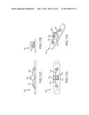 HEART ANCHOR POSITIONING DEVICES, METHODS, AND SYSTEMS FOR TREATMENT OF     CONGESTIVE HEART FAILURE AND OTHER CONDITIONS diagram and image