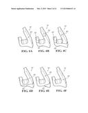 METHODS AND APPARATUS FOR FAI SURGERIES diagram and image