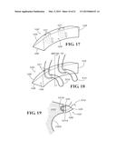 METHODS AND APPARATUS FOR FAI SURGERIES diagram and image