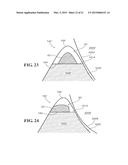 METHODS AND APPARATUS FOR FAI SURGERIES diagram and image