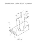 METHODS AND APPARATUS FOR FAI SURGERIES diagram and image