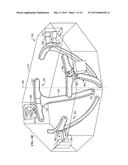 TISSUE-STABILIZATION DEVICE AND METHOD FOR MEDICAL PROCEDURES diagram and image