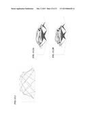 TISSUE-STABILIZATION DEVICE AND METHOD FOR MEDICAL PROCEDURES diagram and image