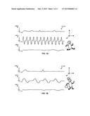 Activating Applications Based on Accelerometer Data diagram and image