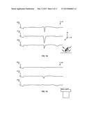 Activating Applications Based on Accelerometer Data diagram and image