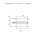 Activating Applications Based on Accelerometer Data diagram and image