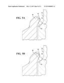 IGNITER ASSEMBLY INCLUDING ARCING REDUCTION FEATURES diagram and image