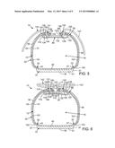 Article Of Footwear With Upper Having Member With Support Arm diagram and image