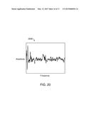 FLAME MONITORING OF A GAS TURBINE COMBUSTOR USING MULTIPLE DYNAMIC     PRESSURE SENSORS IN MULTIPLE COMBUSTORS diagram and image