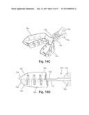 APPARATUSES AND METHODS FOR MANDIBULAR PROTRUSION diagram and image