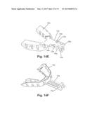 APPARATUSES AND METHODS FOR MANDIBULAR PROTRUSION diagram and image