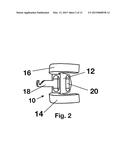 Oral Airway and Intubation Assisting Device diagram and image