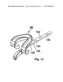 Oral Airway and Intubation Assisting Device diagram and image