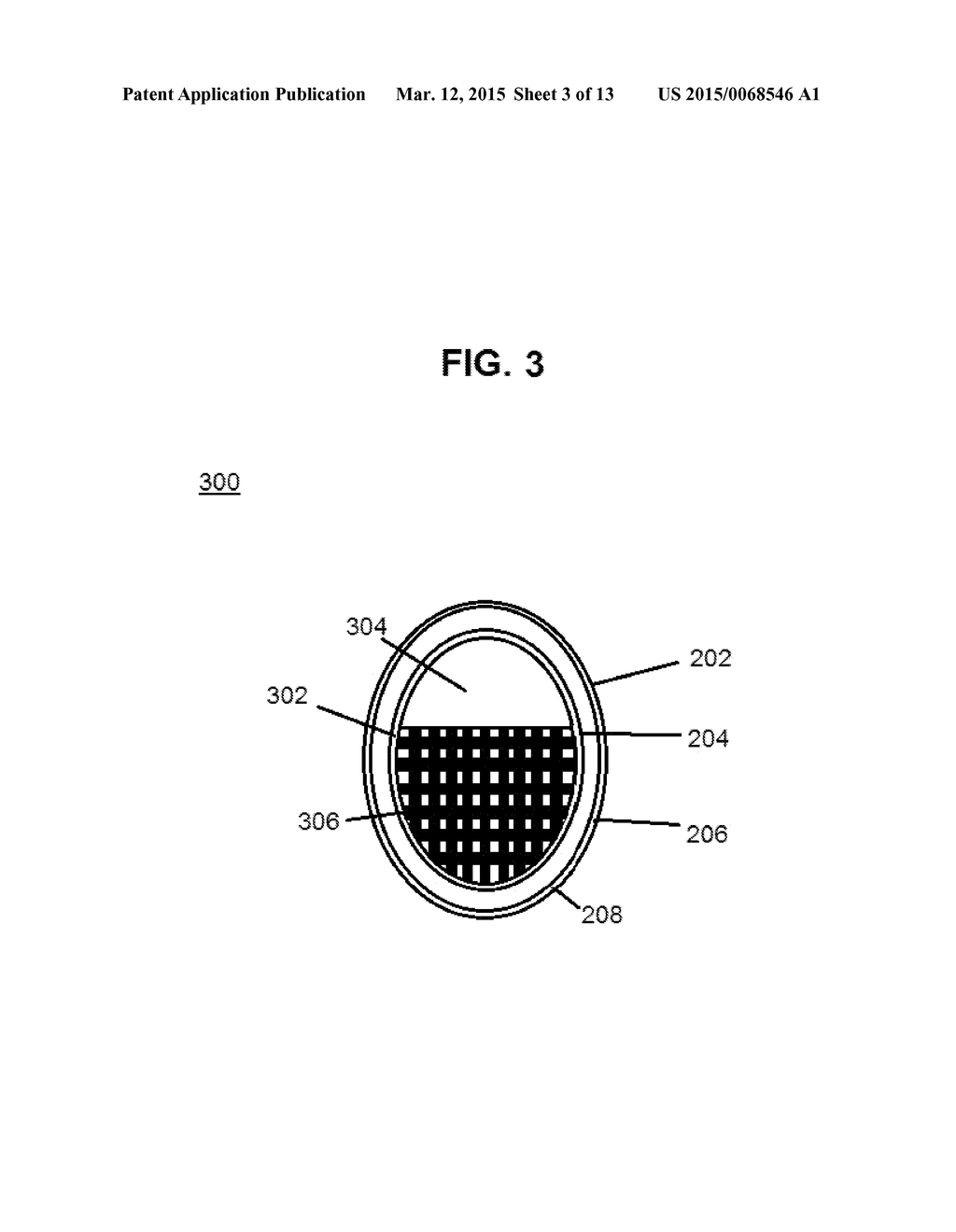 Hair Replacement and Method of Use - diagram, schematic, and image 04