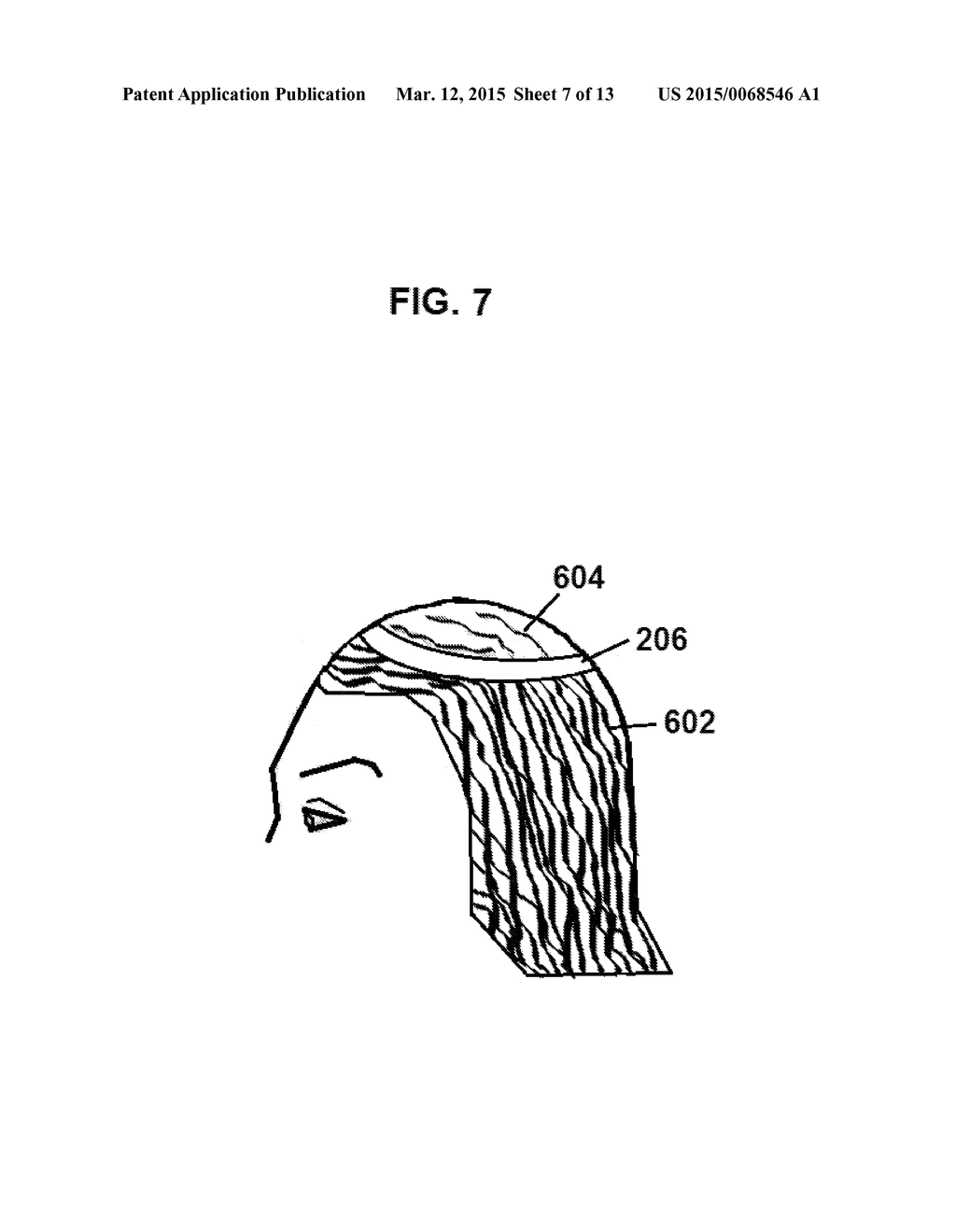 Hair Replacement and Method of Use - diagram, schematic, and image 08