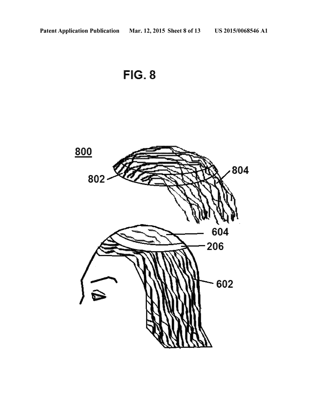Hair Replacement and Method of Use - diagram, schematic, and image 09