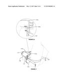 SUPPLEMENTAL RESTRAINT SYSTEM WITH SIX RESTRAINT POINTS diagram and image