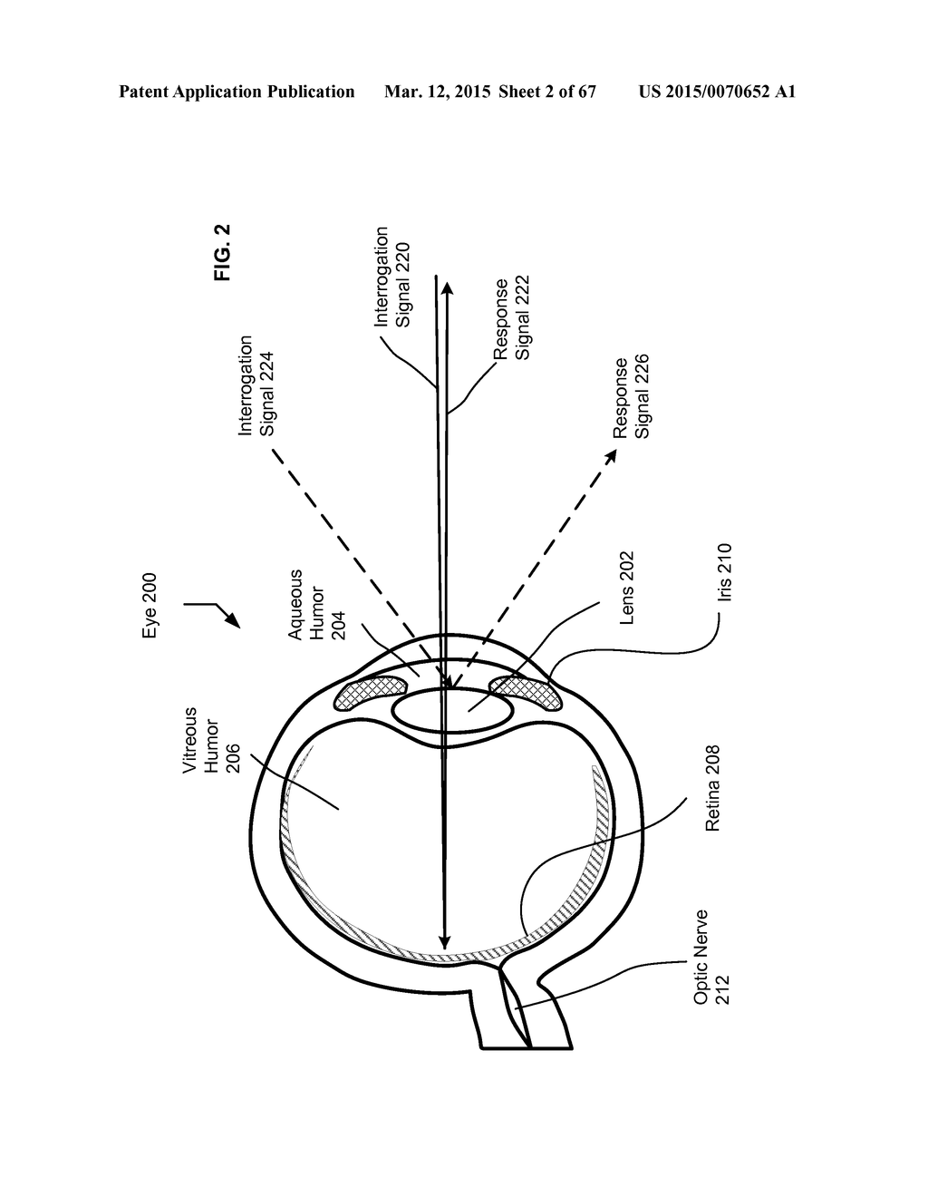 UNOBTRUSIVE ACTIVE EYE INTERROGATION - diagram, schematic, and image 03