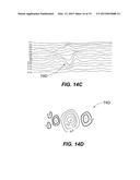 SYSTEMS AND METHODS FOR INSPECTING WOUND OPTICAL FIBER diagram and image