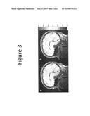 METHODS AND DEVICES FOR OPTIMIZATION OF MAGNETIC RESONANCE IMAGING     PROTOCOLS diagram and image